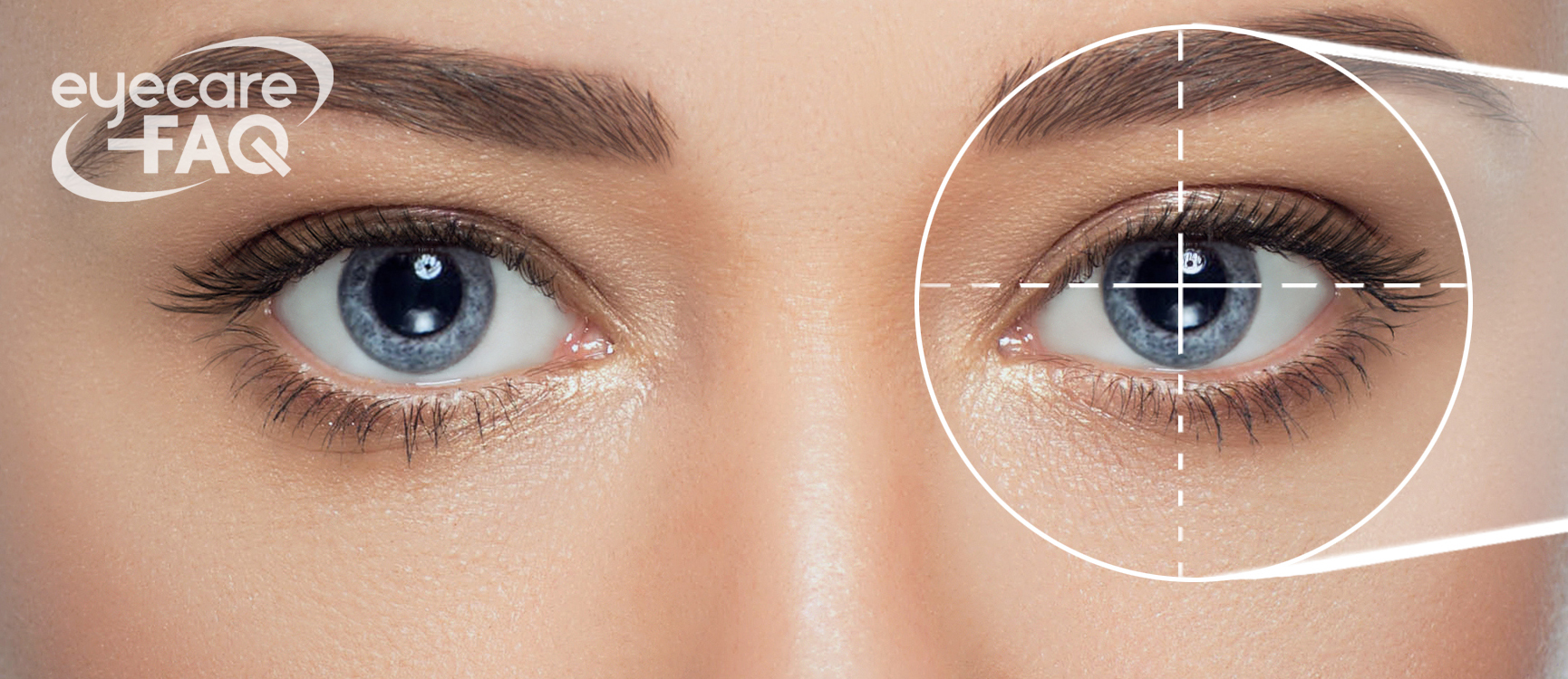 eye conditions